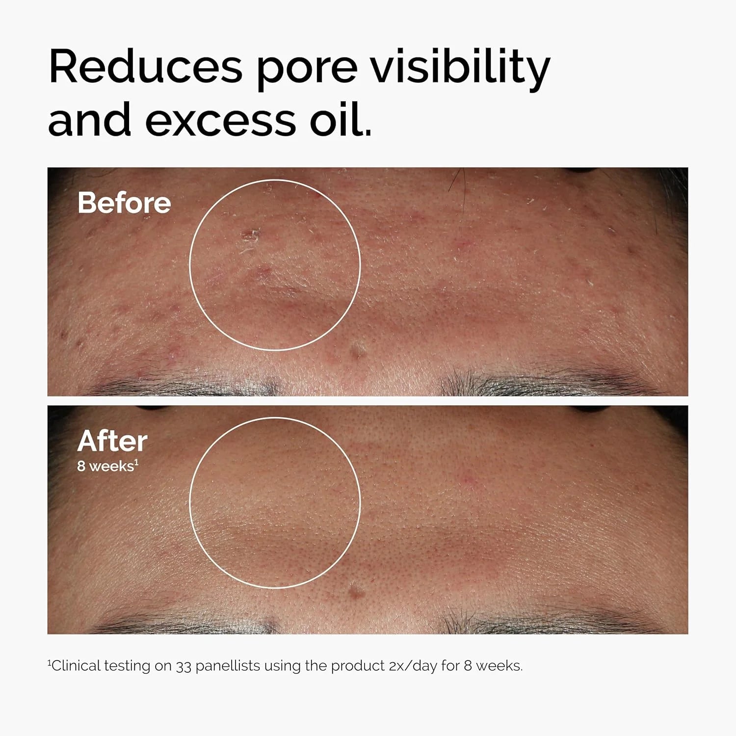 The Original Niacinamide Serum for Clear, Smooth Skin - Image 5